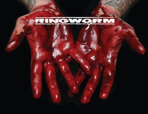 Ringworm2